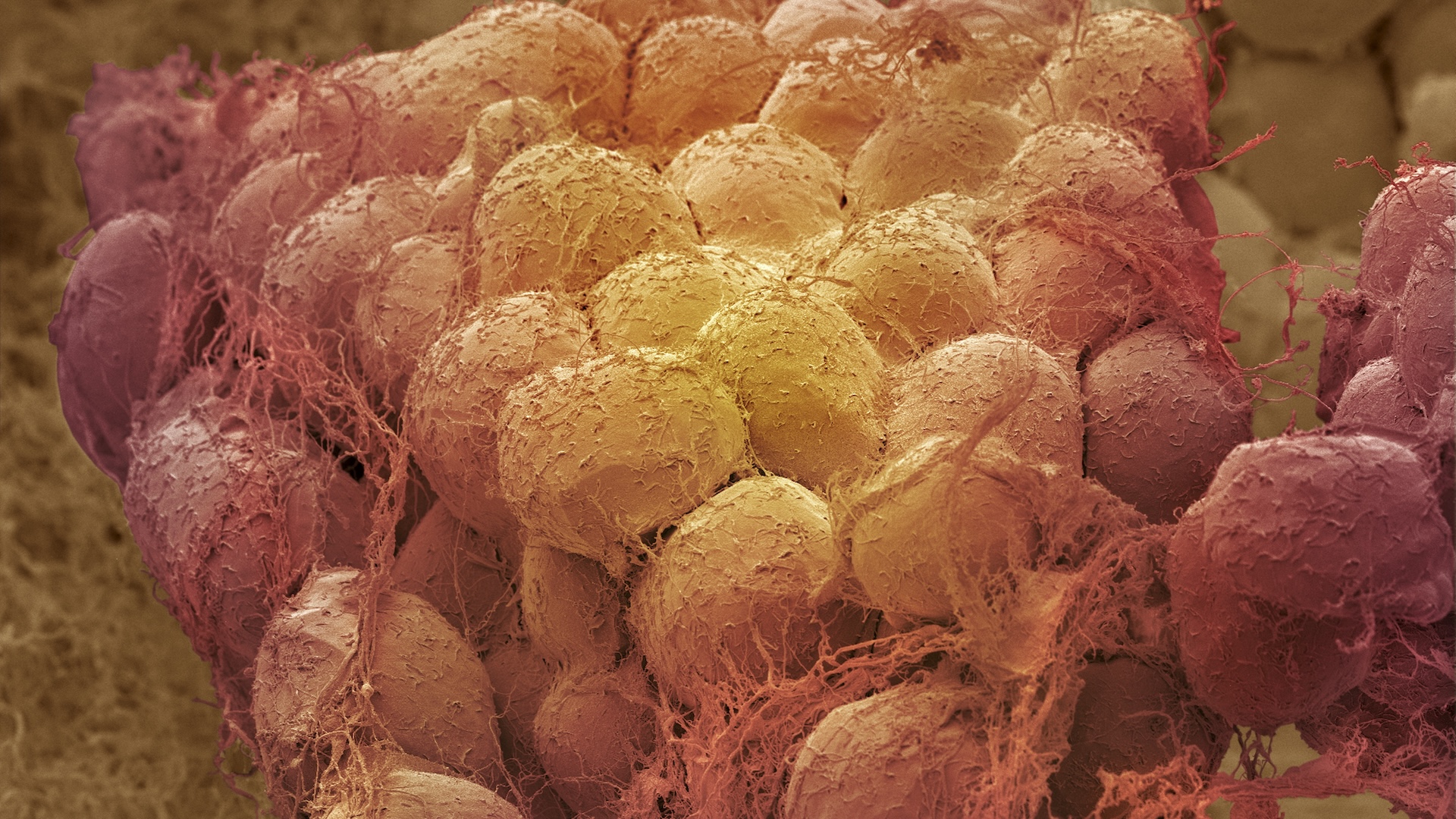 a colorized electron microscope image of fat cells
