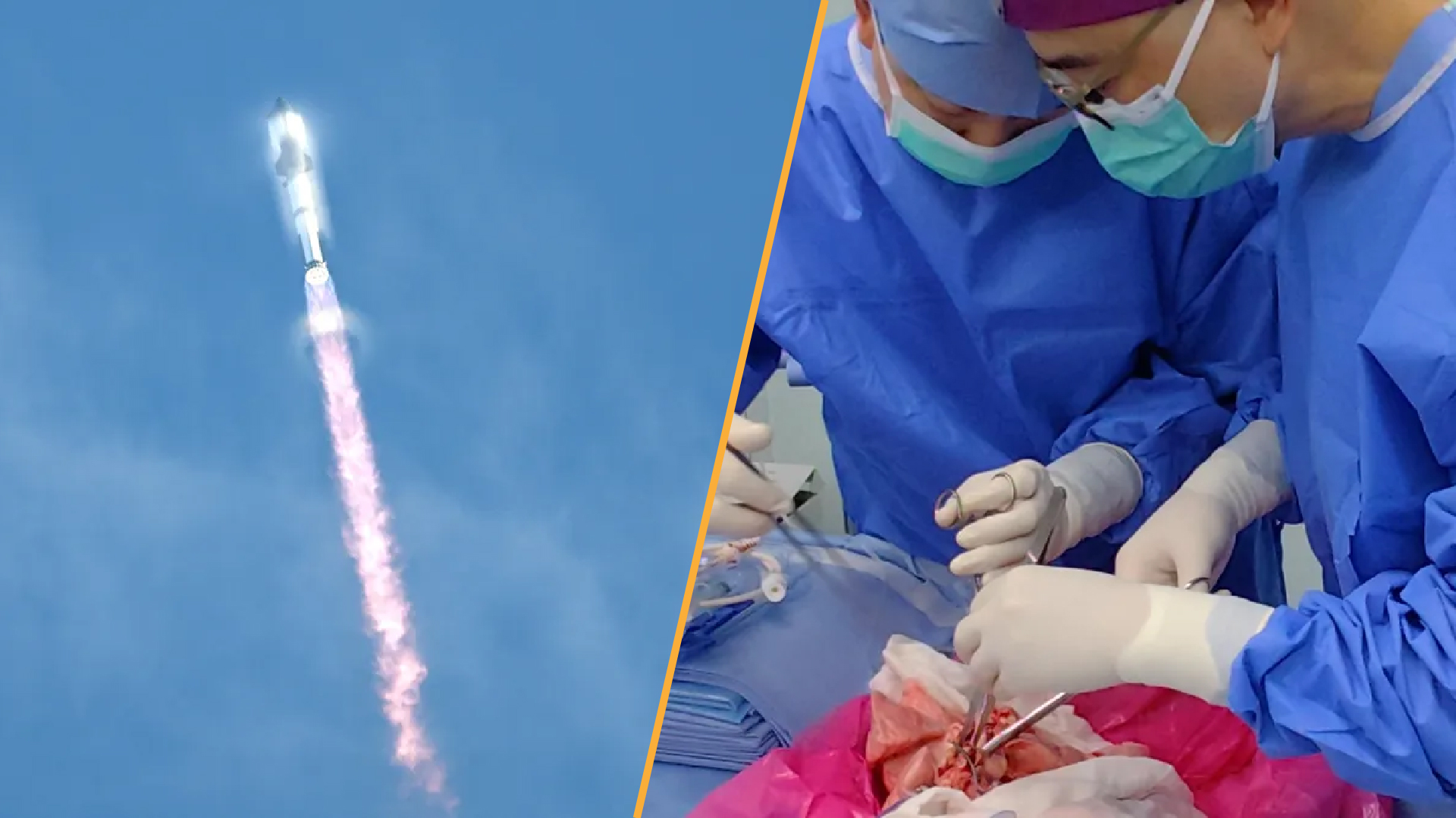 A split-screen image. On the left, a rocket launch. On the right, two surgeons work on a pair of lungs.