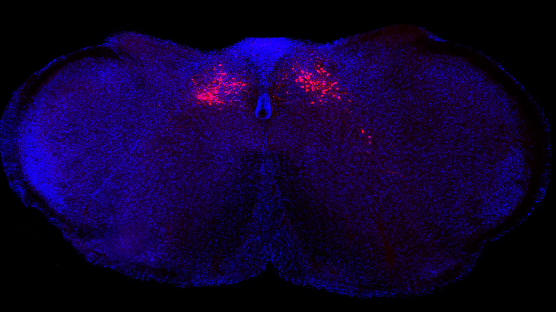 Fluorescent microscope image of the brain stem of a mouse shown in blue against a black background. Red-colored neurons can be seen dotted about towards the top middle portion of the brainstem.