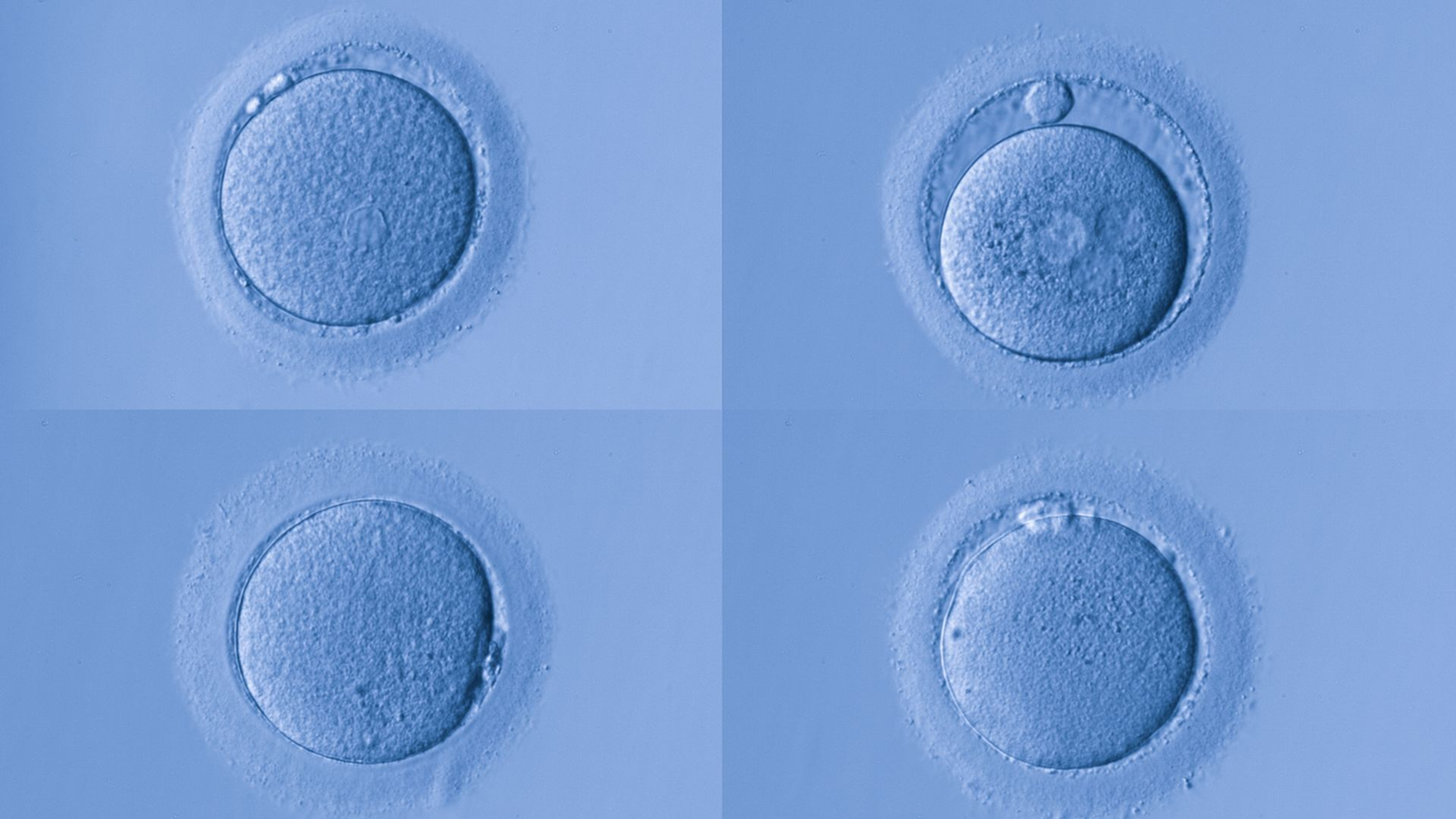 A collage of human egg cells.